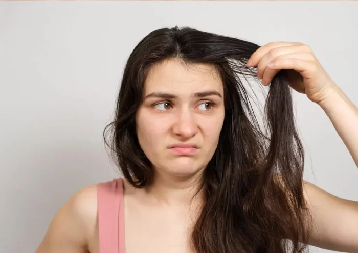 oily hair problem | Sach Bedhadak