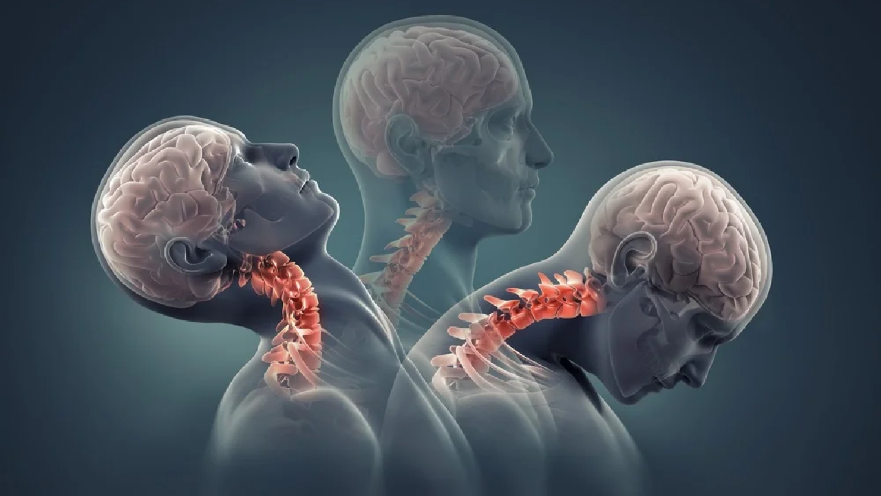 spinal stroke | Sach Bedhadak